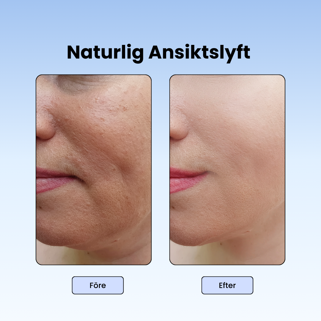 ✨ GlowLift™ Borste ✨- Ditt dagliga lyft – naturligt och skonsamt 💆♀️🌸